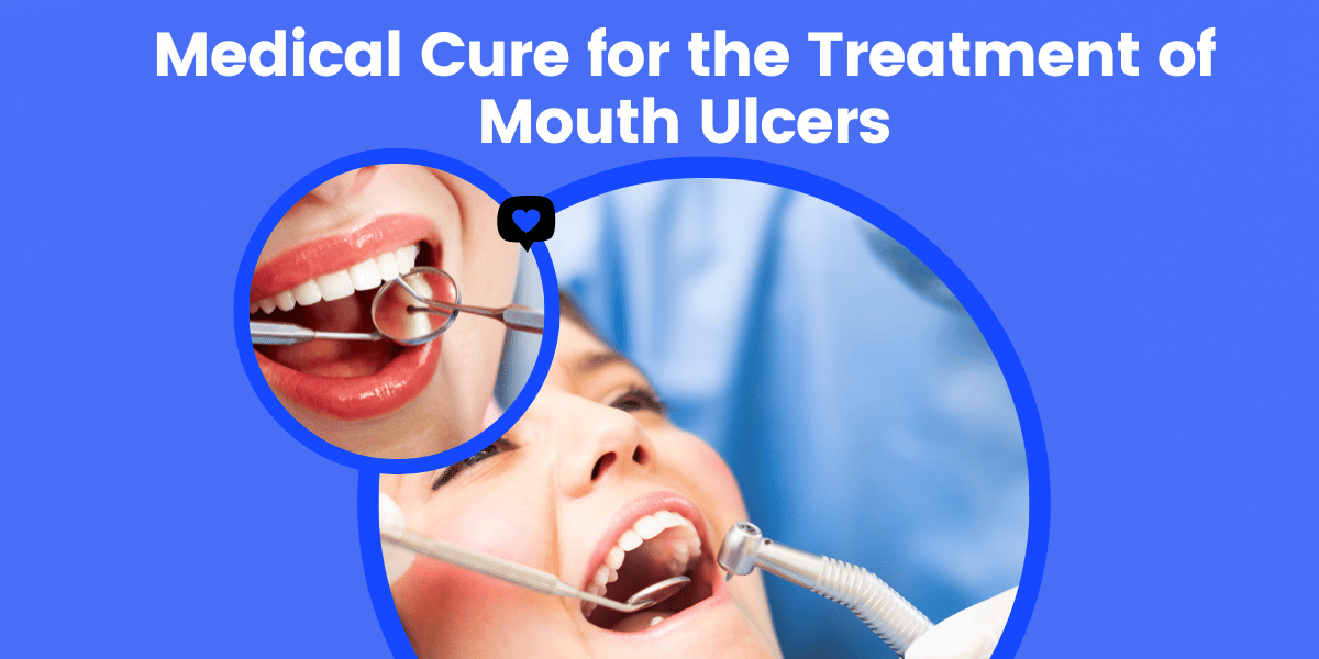 Medical Cure for the Treatment of Mouth Ulcers