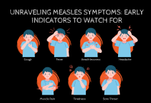 What are The Symptoms of Measles?