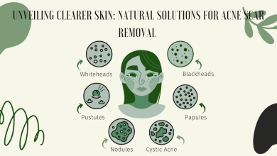 What are Some Natural Products That are Known for Helping to Fade Acne Scars?