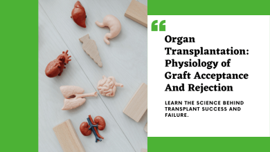 Organ Transplantation